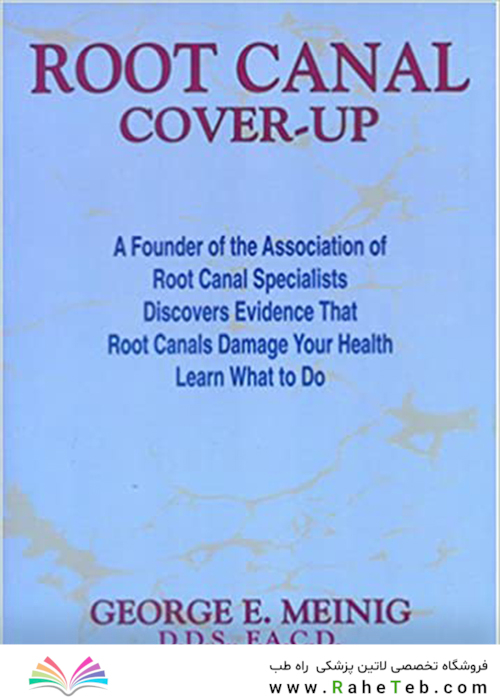 Root Canal Cover Up