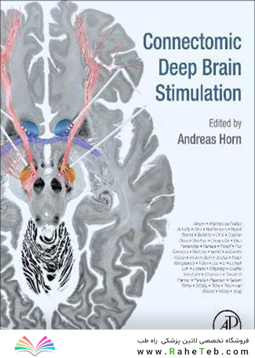 Connectomic Deep Brain Stimulation