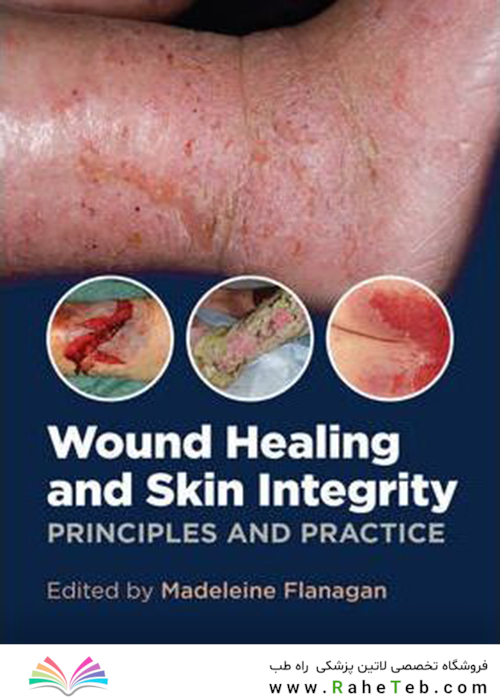 Wound Healing and Skin Integrity