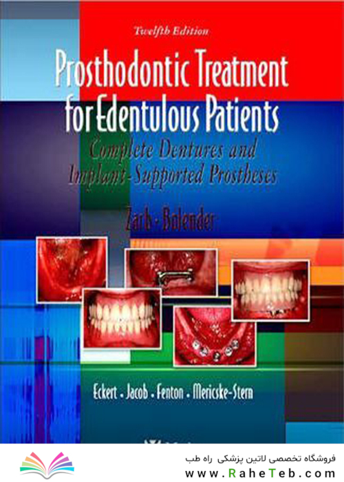 Prosthodontic Treatment for Edentulous Patients