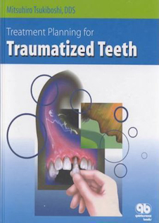 عکس Treatment Planning for Traumatized Teeth