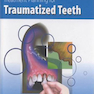 Treatment Planning for Traumatized Teeth