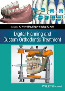 عکس Digital Planning and Custom Orthodontic Treatment