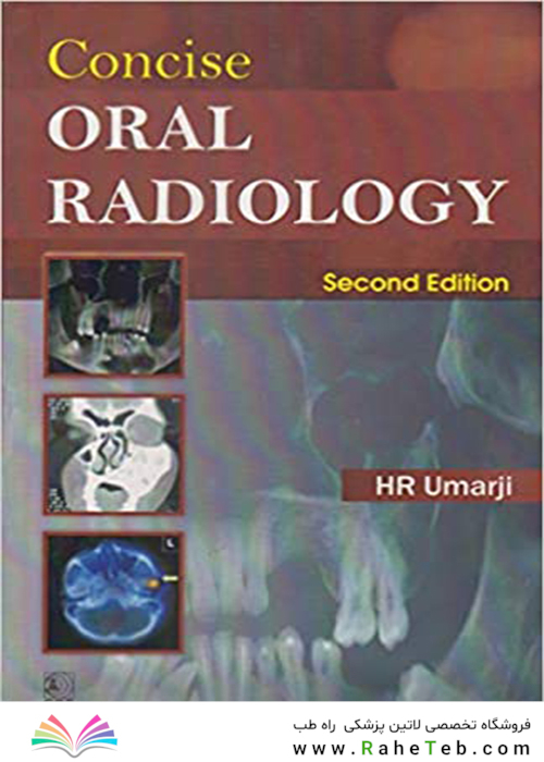 Concise Oral Radiology