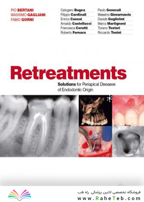 Retreatment. Solutions for apical diseases of endodontic origin