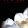 Tooth Preparations 1st Edicion 2017