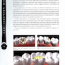 Tooth Preparations 1st Edicion 2017