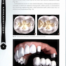 Tooth Preparations 1st Edicion 2017