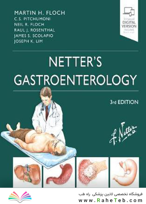 Netter