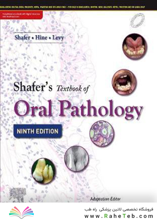 Shafer