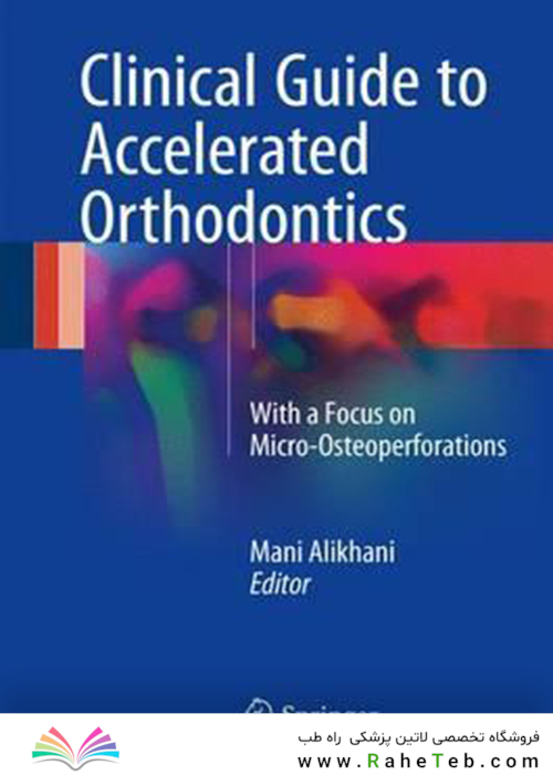 Clinical Guide to Accelerated Orthodontics : With a Focus on Micro-Osteoperforations