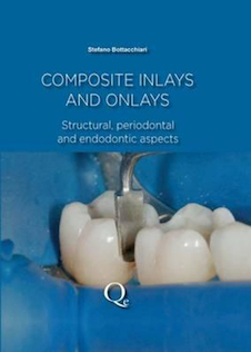 عکس Composite Inlays and Onlays : Structural, Periodontal, and Endodontic Aspects