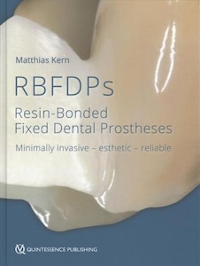 عکس Rbfdps : Resin-Bonded Fixed Dental Prostheses: Minimally Invasive - Esthetic - Reliable
