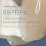 Rbfdps : Resin-Bonded Fixed Dental Prostheses: Minimally Invasive - Esthetic - Reliable