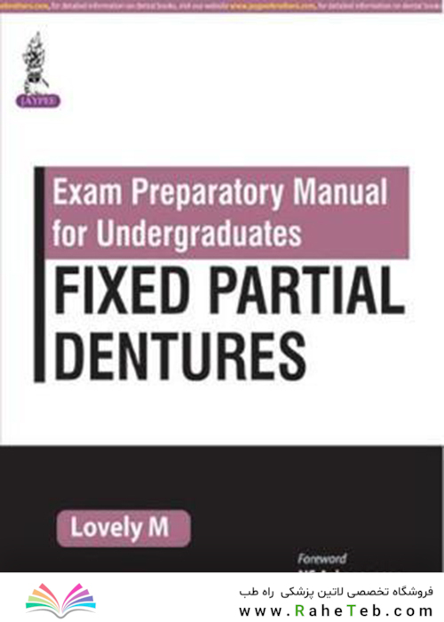Fixed Partial Dentures