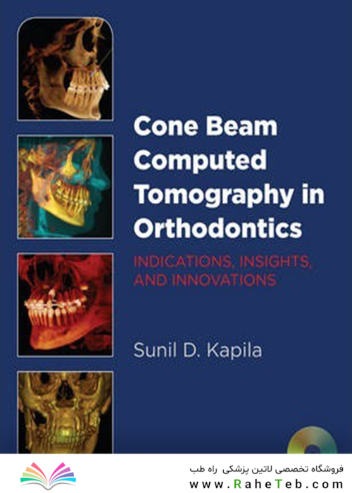 Cone Beam Computed Tomography in Orthodontics : Indications, Insights, and Innovations
