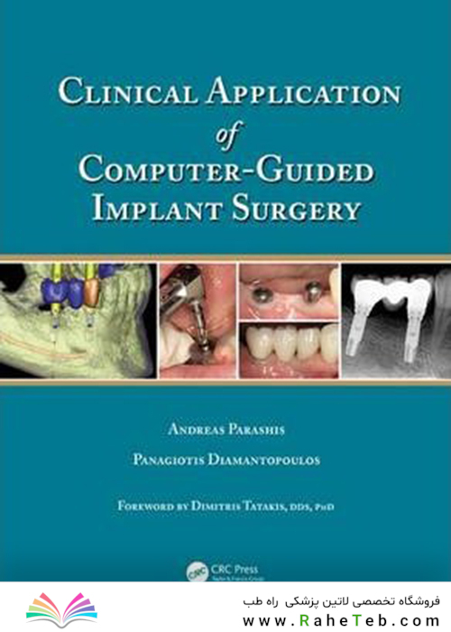 Clinical Application of Computer-Guided Implant Surgery