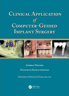 عکس Clinical Application of Computer-Guided Implant Surgery