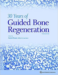 عکس 30Years of Guided Bone Regeneration in Implant Dentistry