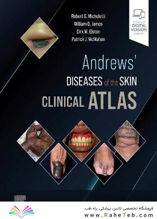 Andrews
