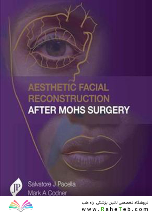Aesthetic Facial Reconstruction After Mohs Surgery