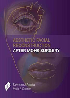 عکس Aesthetic Facial Reconstruction After Mohs Surgery