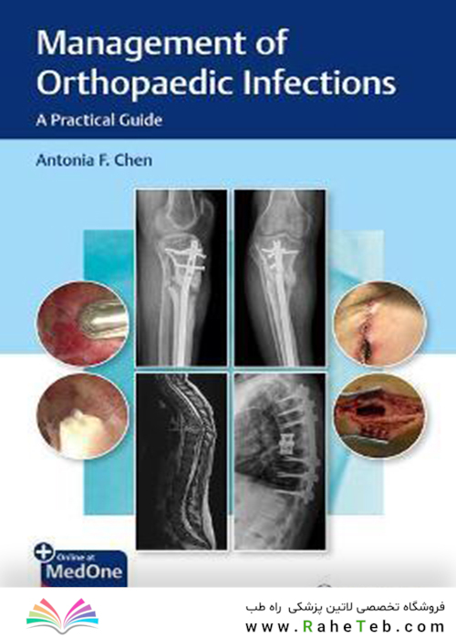 Management of Orthopaedic Infections: A Practical Guide 1st Edición