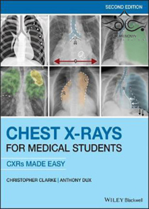 عکس Chest X-Rays for Medical Students: CXRs Made Easy 2nd Edition2020