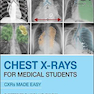 Chest X-Rays for Medical Students: CXRs Made Easy 2nd Edition2020