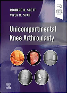 عکس Unicompartmental Knee Arthroplasty