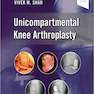 Unicompartmental Knee Arthroplasty