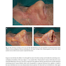 Rhinoplasty: An Anatomical and Clinical Atlas 1st ed Edition 2018