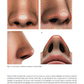 Rhinoplasty: An Anatomical and Clinical Atlas 1st ed Edition 2018