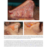 Rhinoplasty: An Anatomical and Clinical Atlas 1st ed Edition 2018
