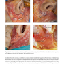 Rhinoplasty: An Anatomical and Clinical Atlas 1st ed Edition 2018