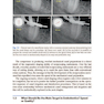 Shaping for Cleaning the Root Canals : A Clinical-Based Strategy 2022