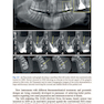 Shaping for Cleaning the Root Canals : A Clinical-Based Strategy 2022