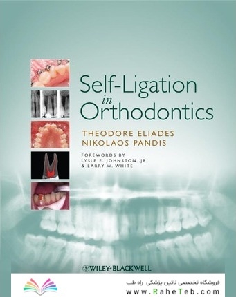 Self-Ligation in Orthodontics 1st Edición