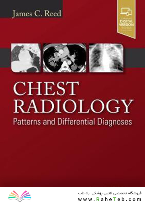Chest Radiology : Patterns and Differential Diagnoses