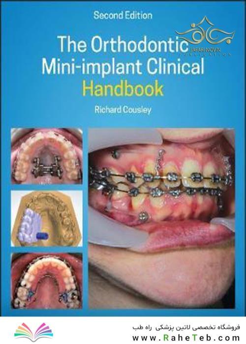 The Orthodontic Mini-implant Clinical Handbook 2nd Edition, Kindle Edition 2020