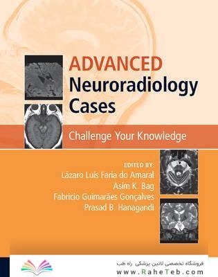 Advanced Neuroradiology Cases: Challenge Your Knowledge 1st Edición