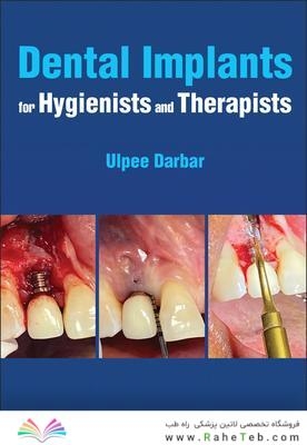 Dental Implants for Hygienists and Therapists 1st Edición