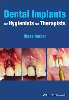 عکس Dental Implants for Hygienists and Therapists 1st Edición