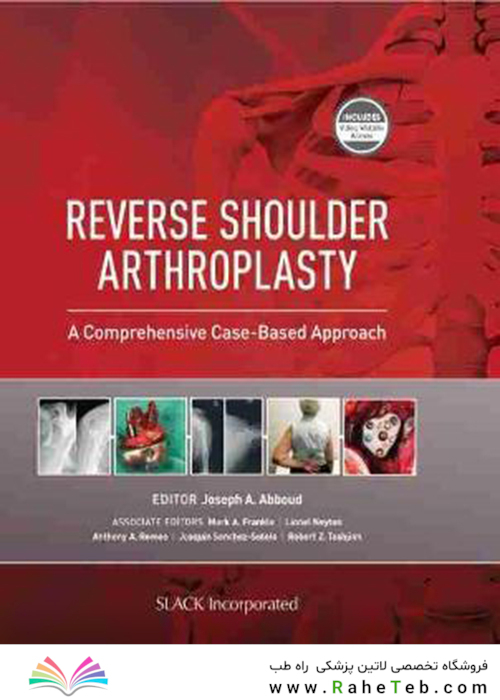 Reverse Shoulder Arthroplasty : A Comprehensive Case-Based Approach