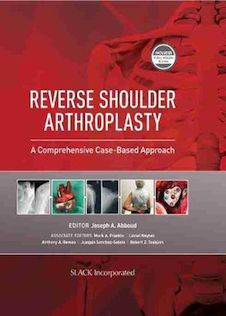 عکس Reverse Shoulder Arthroplasty : A Comprehensive Case-Based Approach