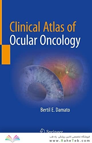 Clinical Atlas of Ocular Oncology
