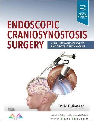 Endoscopic Craniosynostosis Surgery : An Illustrated Guide to Endoscopic Techniques