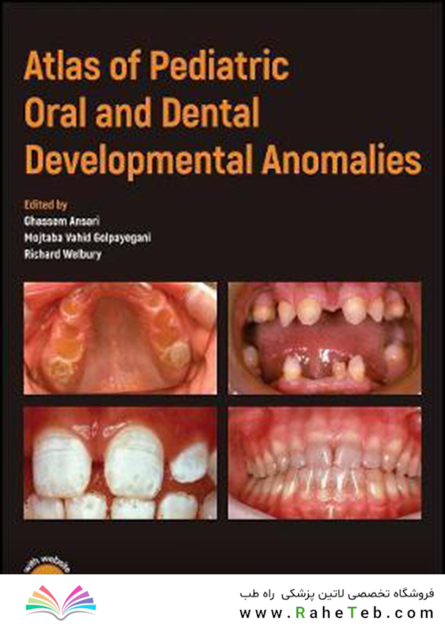 Atlas of Pediatric Oral and Dental Developmental Anomalies2019