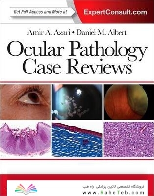 Ocular Pathology Case Reviews 1st Edition2014