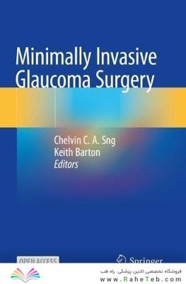 Minimally Invasive Glaucoma Surgery 1st ed